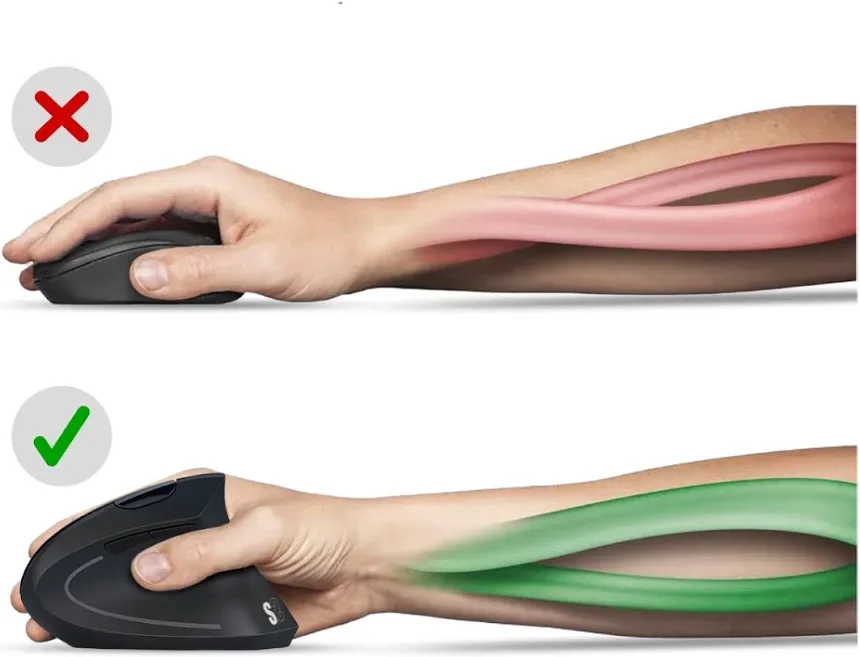 SUBBLIM Glide Vertical Ergo Dual Blanc - vue 5